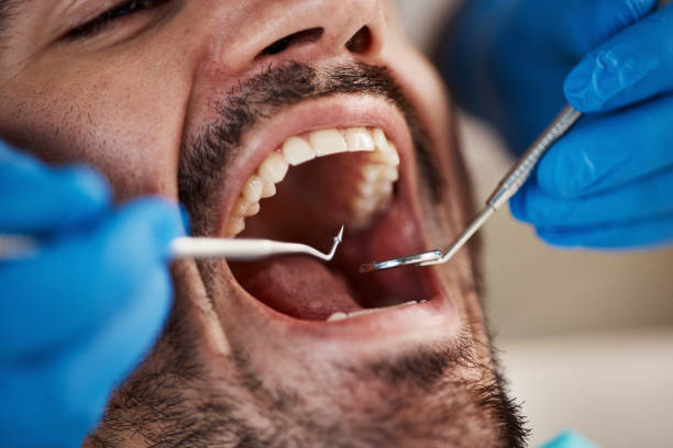 Best Emergency Tooth Extraction in Green, OH