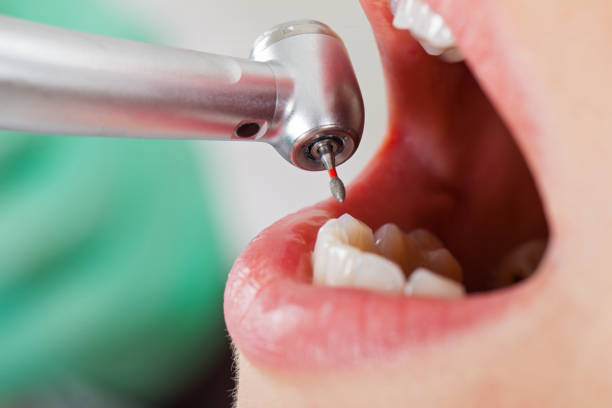 Best Emergency Gum Treatment in Green, OH